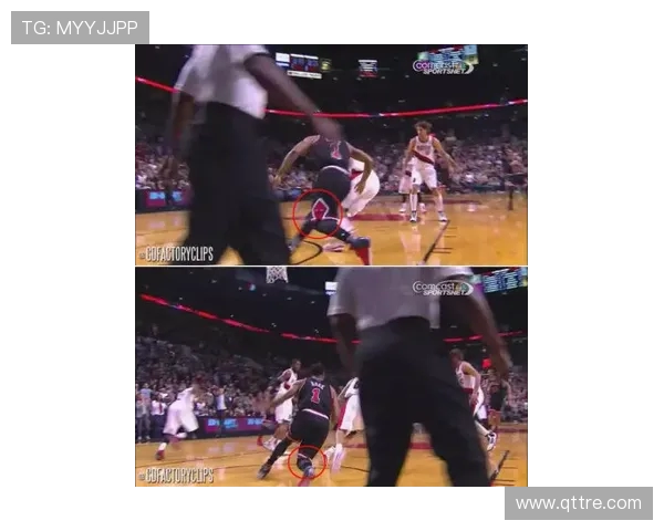 浙江男篮沈无敌左膝半月板撕裂将休战六个月冲击赛季前景康复期